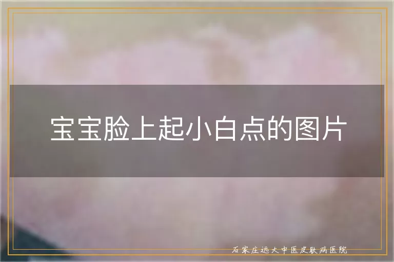 宝宝脸上起小白点的图片