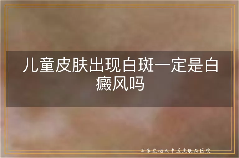 儿童皮肤出现白斑一定是白癜风吗