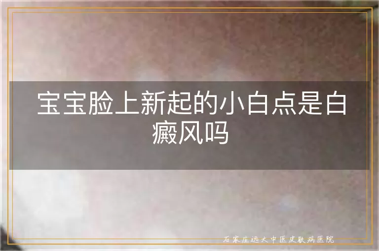 宝宝脸上新起的小白点是白癜风吗