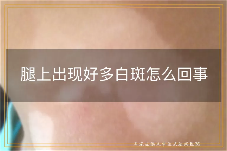 腿上出现好多白斑怎么回事