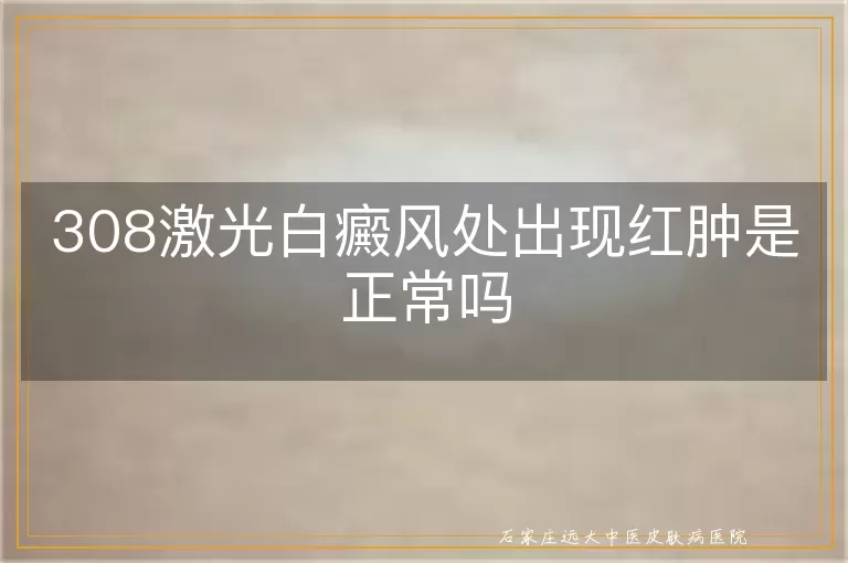 308激光白癜风处出现红肿是正常吗