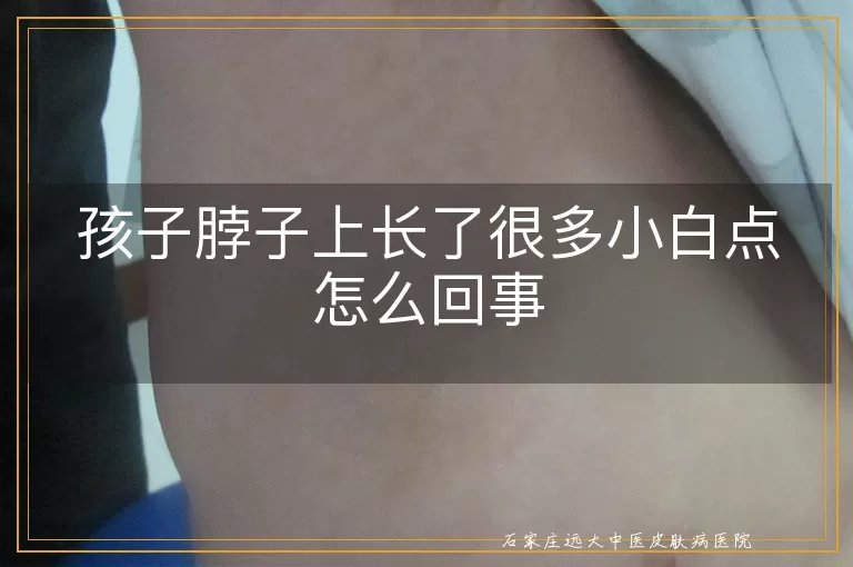 孩子脖子上长了很多小白点怎么回事