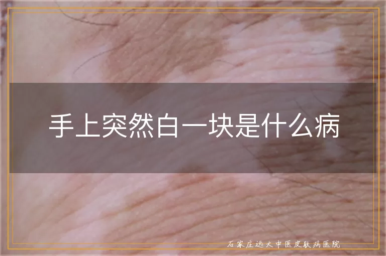 手上突然白一块是什么病