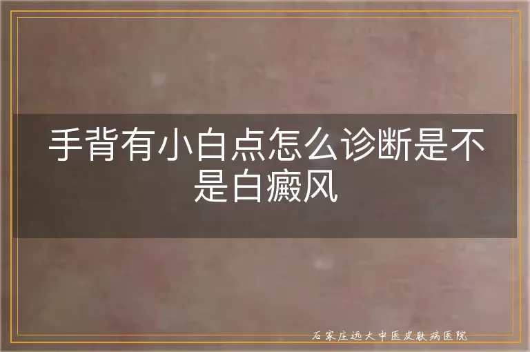 手背有小白点怎么诊断是不是白癜风
