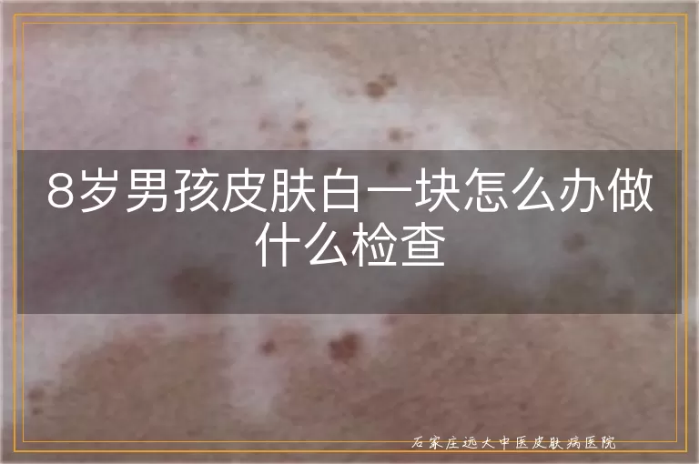 8岁男孩皮肤白一块怎么办做什么检查