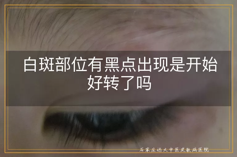 白斑部位有黑点出现是开始好转了吗