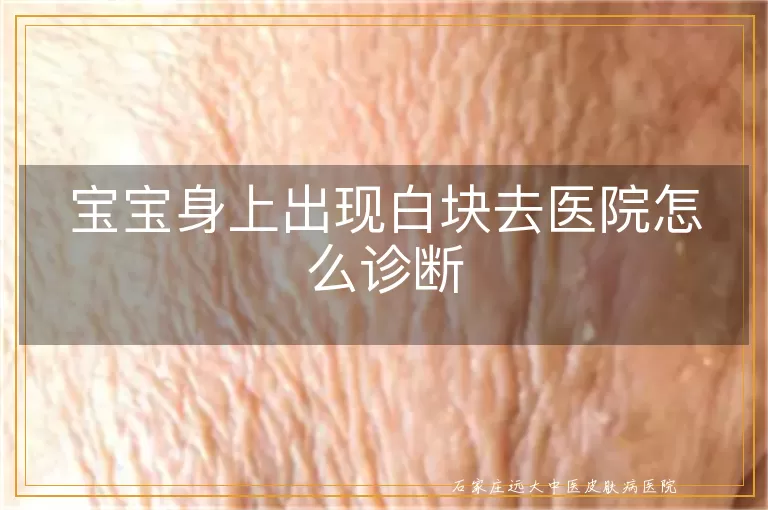 宝宝身上出现白块去医院怎么诊断