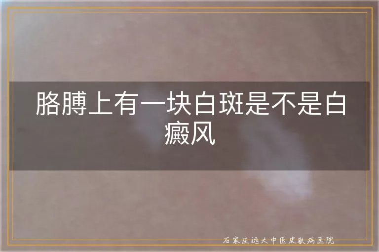 胳膊上有一块白斑是不是白癜风