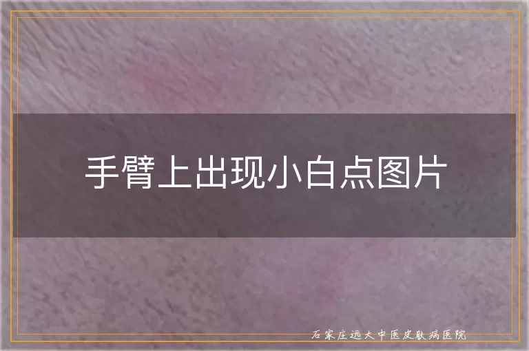 手臂上出现小白点图片