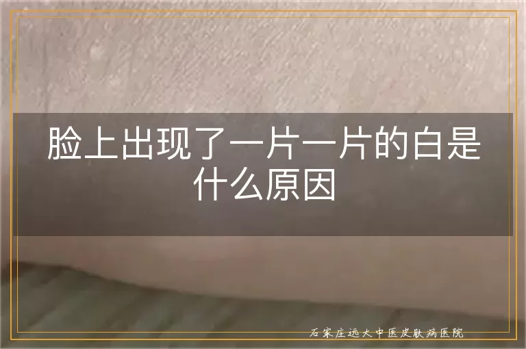 脸上出现了一片一片的白是什么原因
