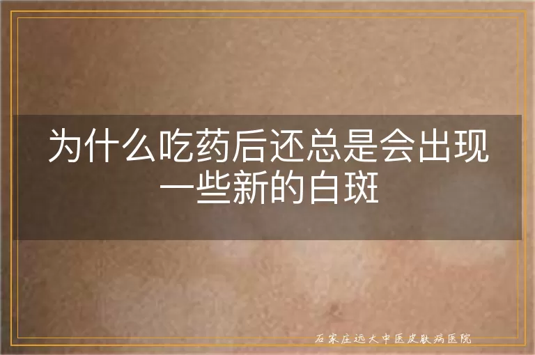 为什么吃药后还总是会出现一些新的白斑