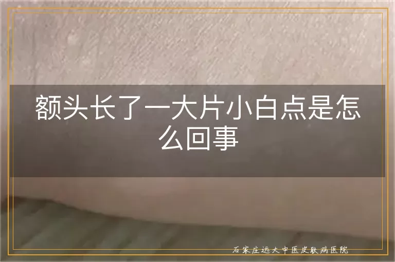 额头长了一大片小白点是怎么回事