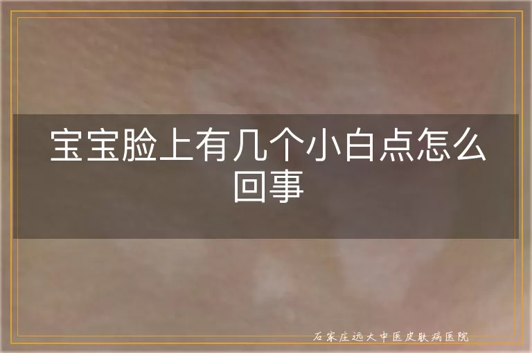 宝宝脸上有几个小白点怎么回事
