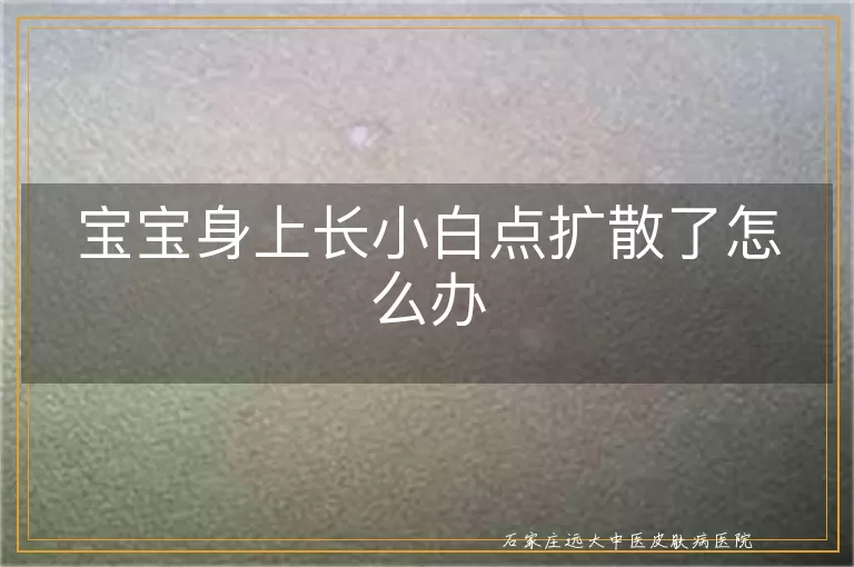 宝宝身上长小白点扩散了怎么办