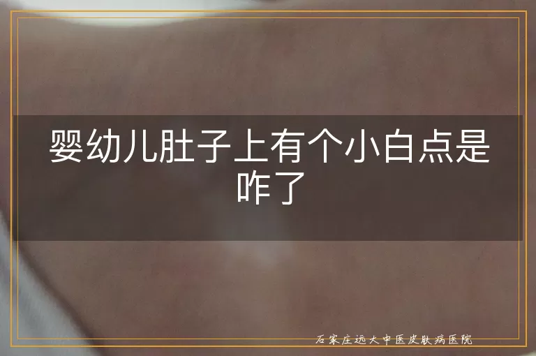 婴幼儿肚子上有个小白点是咋了