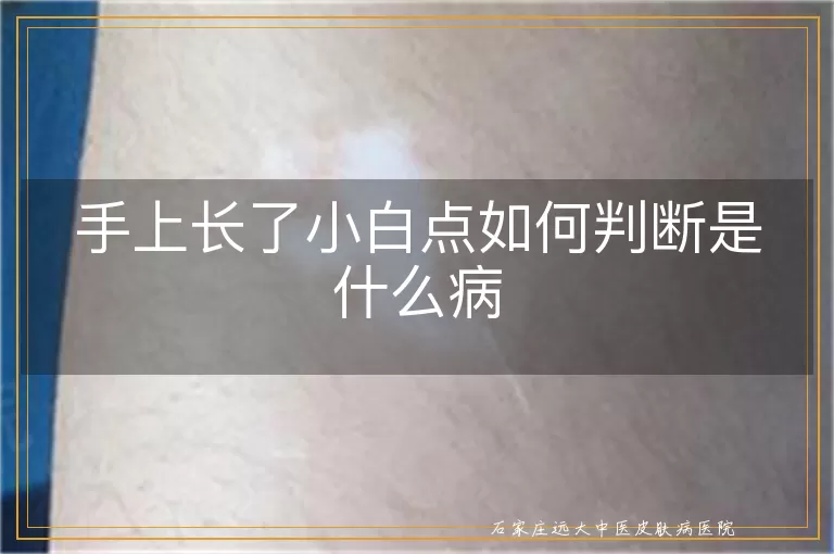手上长了小白点如何判断是什么病