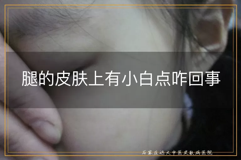 腿的皮肤上有小白点咋回事