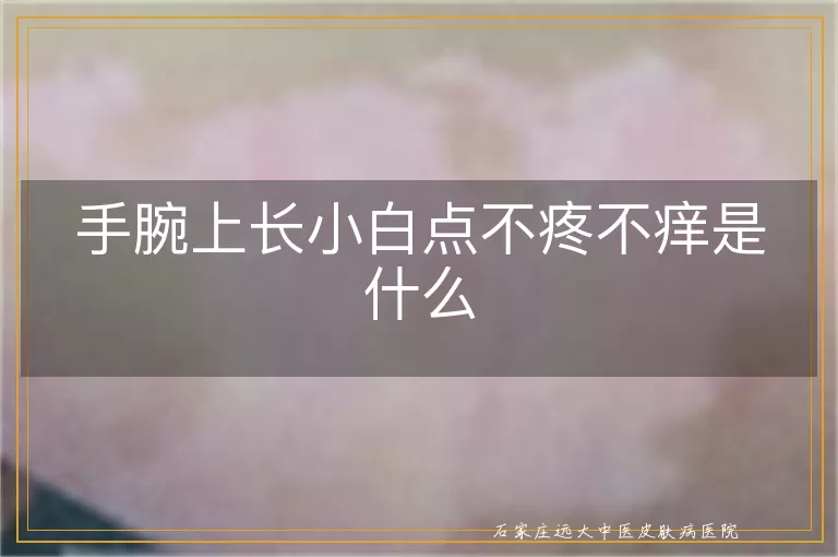 手腕上长小白点不疼不痒是什么