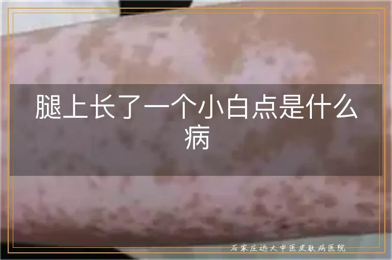 腿上长了一个小白点是什么病