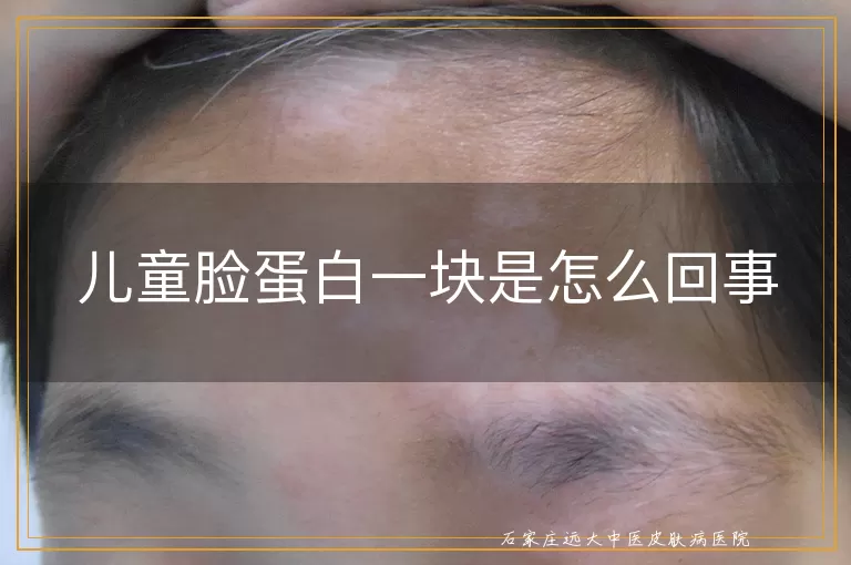 儿童脸蛋白一块是怎么回事