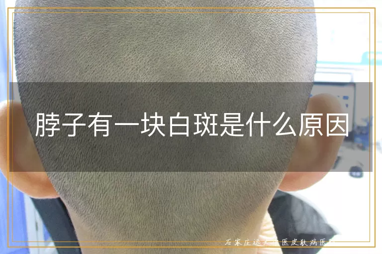 脖子有一块白斑是什么原因
