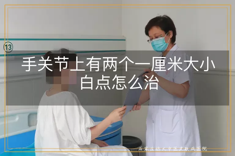 手关节上有两个一厘米大小白点怎么治