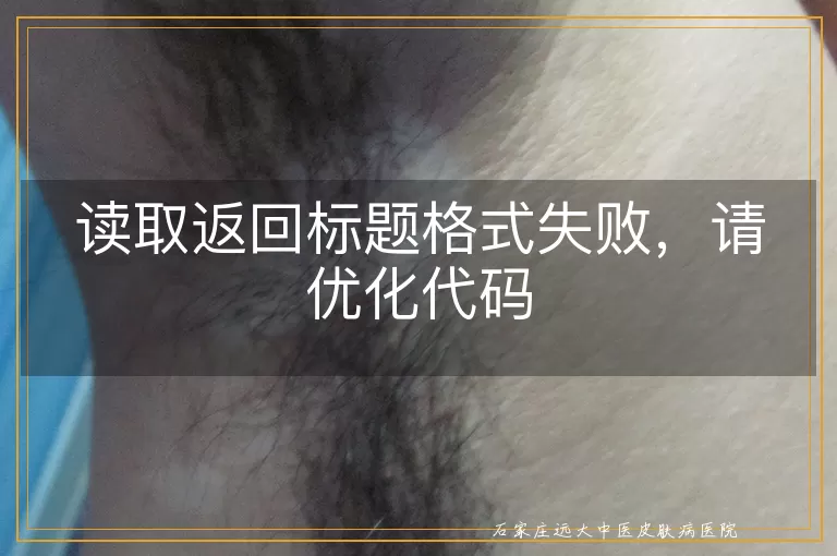 读取返回标题格式失败，请优化代码