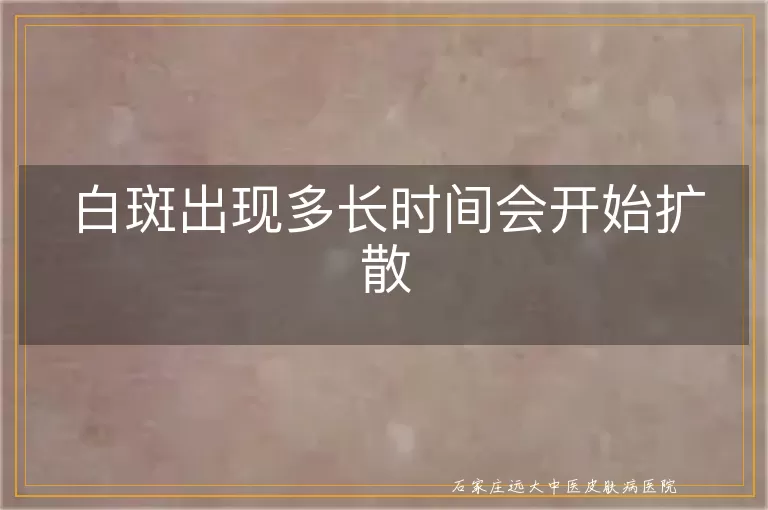 白斑出现多长时间会开始扩散