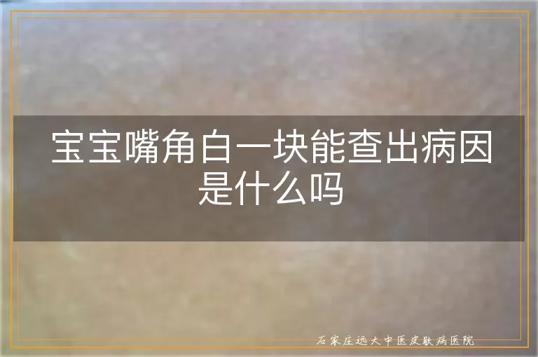 宝宝嘴角白一块能查出病因是什么吗