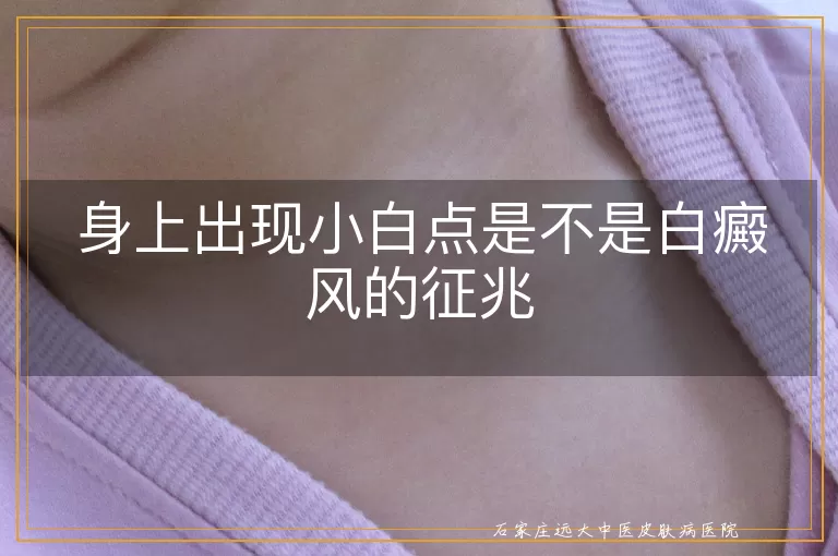 身上出现小白点是不是白癜风的征兆