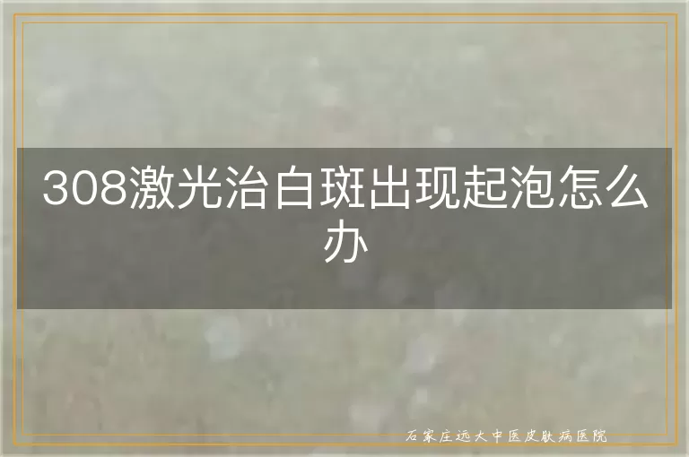 308激光治白斑出现起泡怎么办