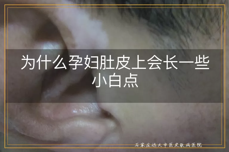 为什么孕妇肚皮上会长一些小白点