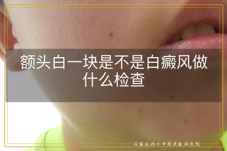 额头白一块是不是白癜风做什么检查
