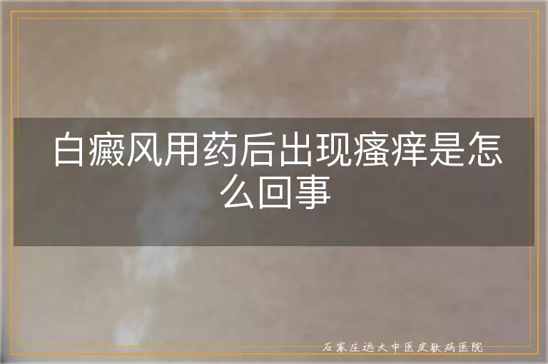 白癜风用药后出现瘙痒是怎么回事