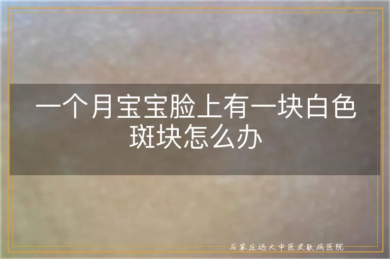 一个月宝宝脸上有一块白色斑块怎么办