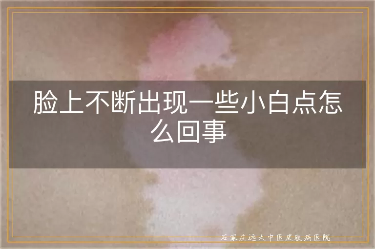 脸上不断出现一些小白点怎么回事