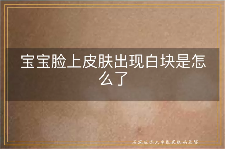 宝宝脸上皮肤出现白块是怎么了