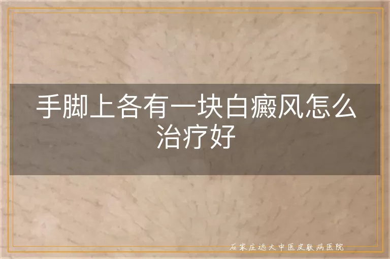 手脚上各有一块白癜风怎么治疗好