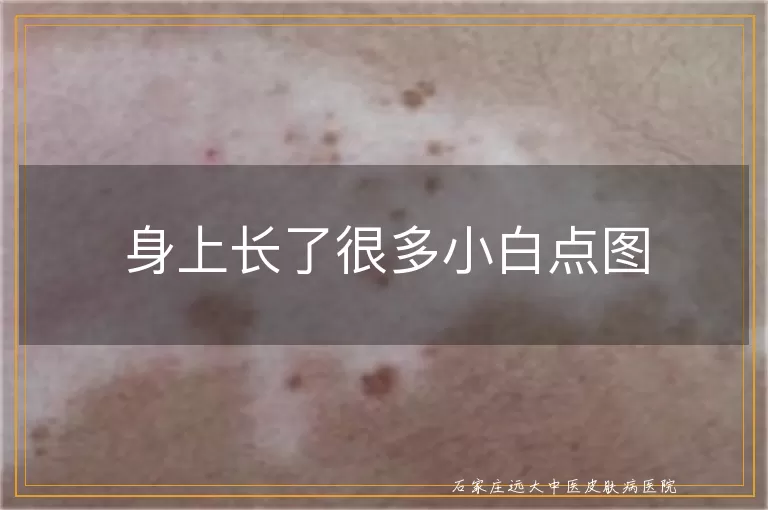身上长了很多小白点图