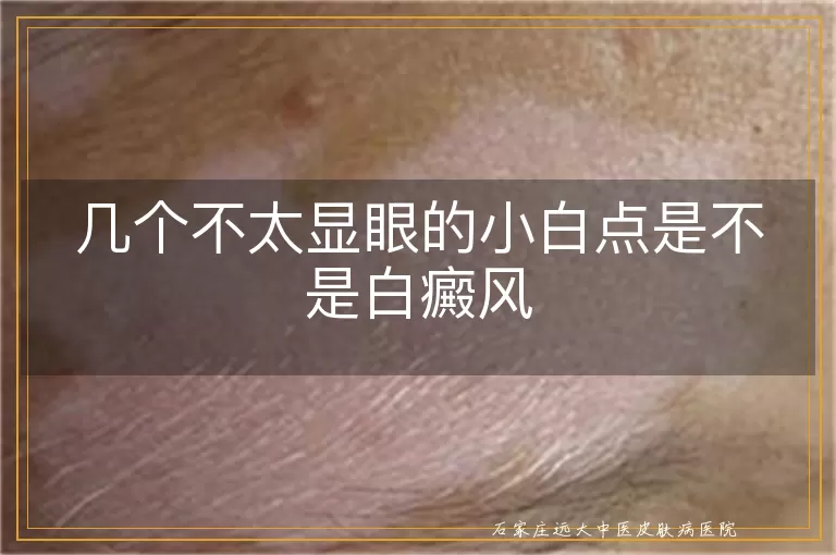 几个不太显眼的小白点是不是白癜风