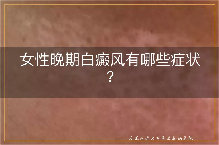 女性晚期白癜风有哪些症状?