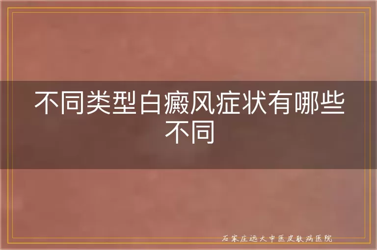 不同类型白癜风症状有哪些不同