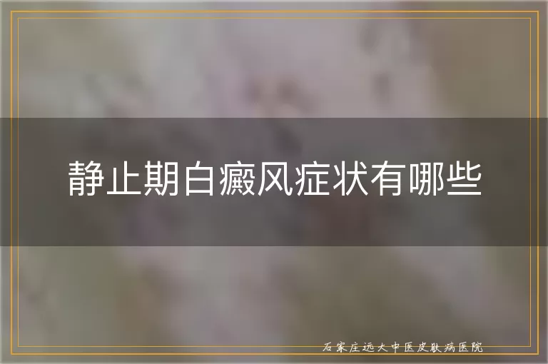 静止期白癜风症状有哪些