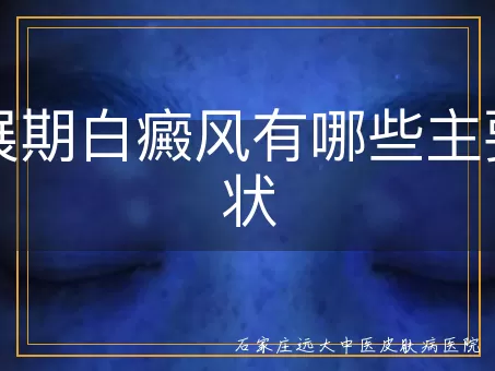 进展期白癜风有哪些主要症状
