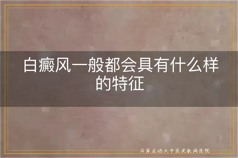 白癜风一般都会具有什么样的特征