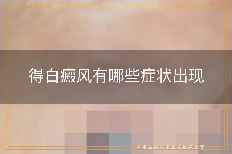 得白癜风有哪些症状出现