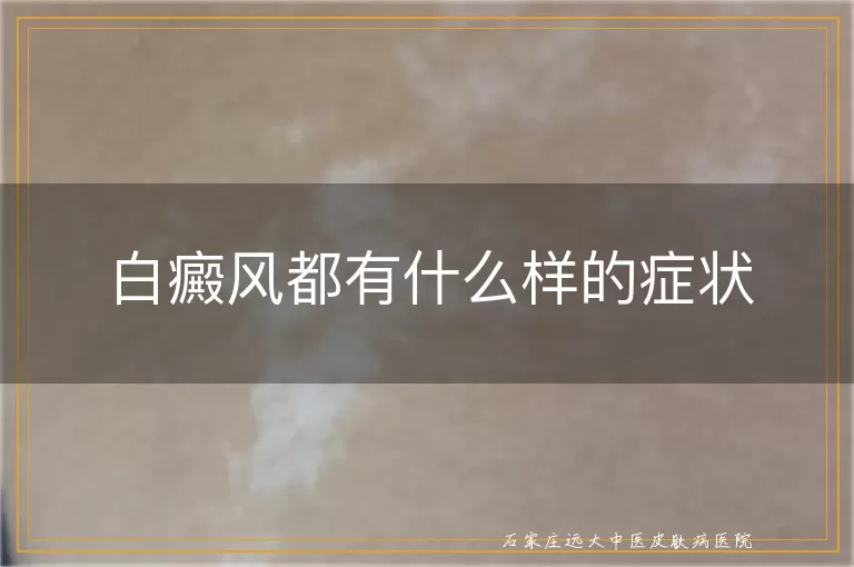 白癜风都有什么样的症状