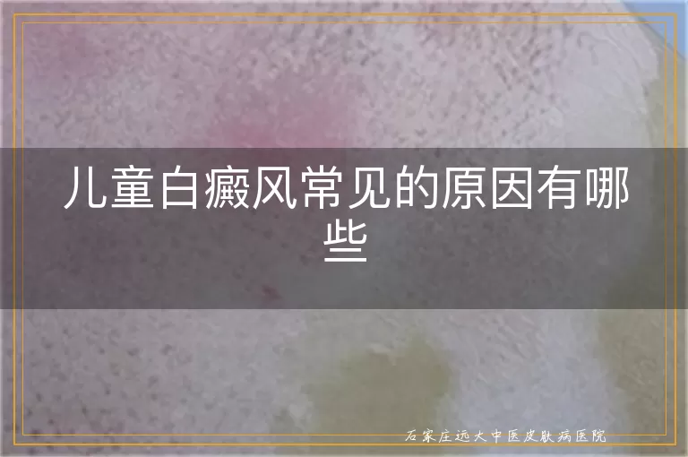 儿童白癜风常见的原因有哪些