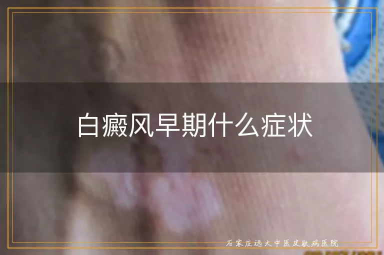 白癜风早期什么症状