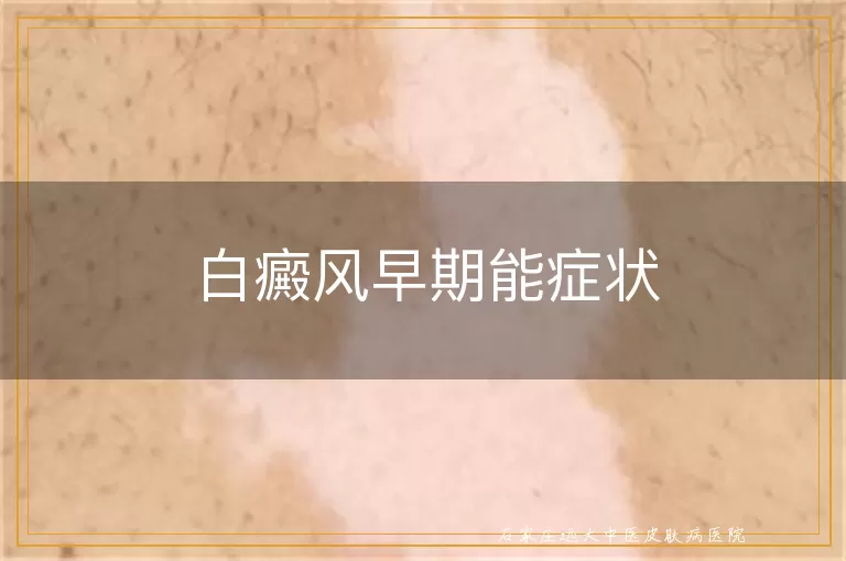 白癜风早期能症状